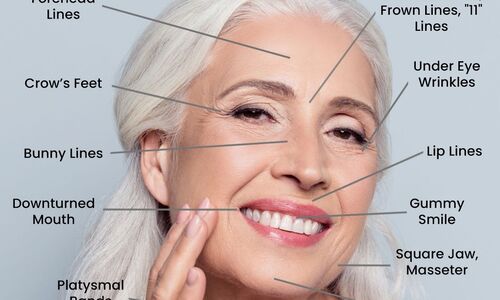 ANTI-WRINKLE TREATMENT